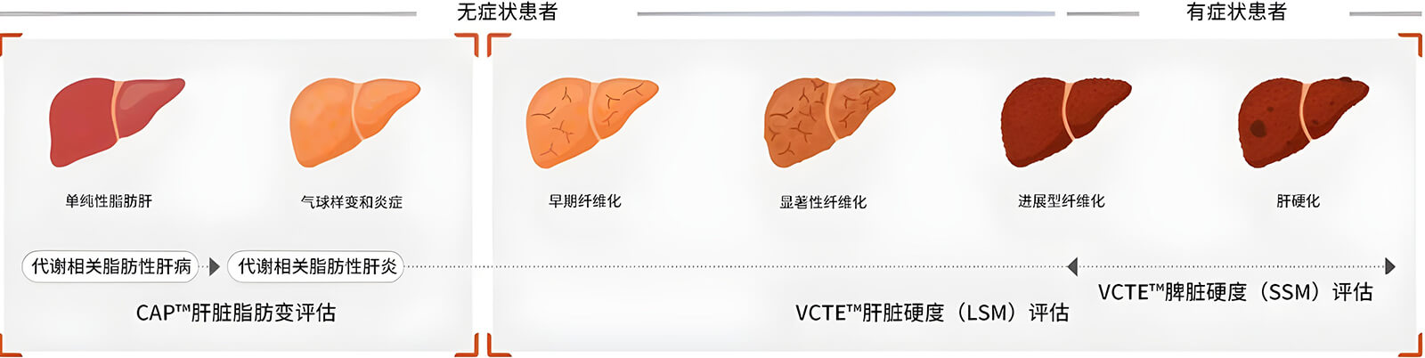 Two core technologies of FibroScan®
