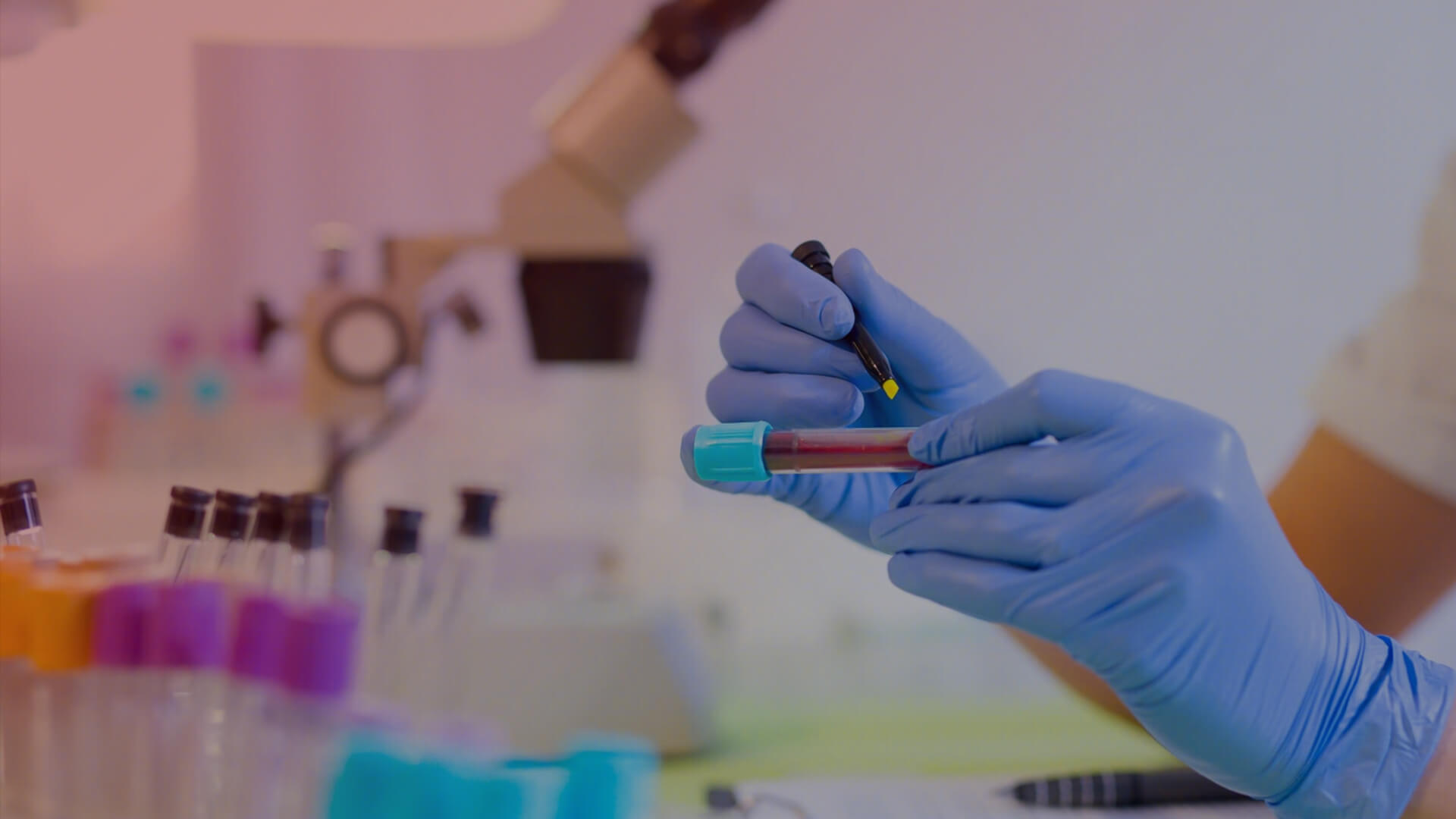 Compound Biejia Ruangan Tablets combined with Entecavir for Antiviral and Antifibrotic Therapy